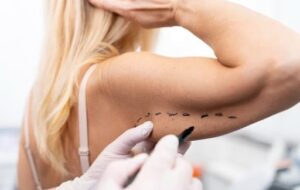 Lipoaspiração tradicional e lipoaspiração a laser