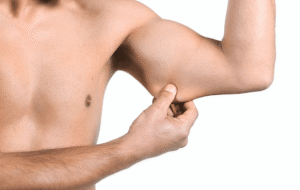 Como a Cirurgia Plástica pode Auxiliar no Combate à Flacidez de Pele